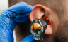 "Plivačko uho" - kako ga spriječiti i prepoznati simptome