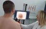 Kampanja "Euromelanoma 2023": Sumnja na melanom kože kod dvije osobe